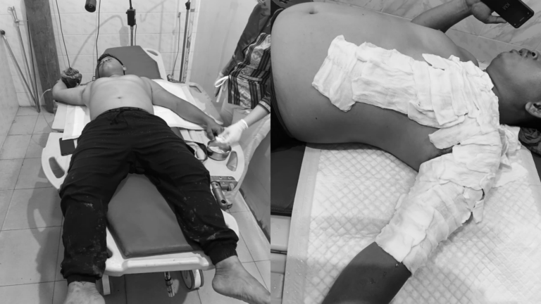 Risiko Tinggi, Petugas Damkar Terkena Api Saat Bertugas